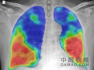 免费的AI软件有助于在胸部X光片中找到COVID-19 中国机械网,okmao.com