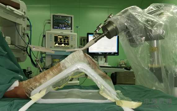手腕舟骨骨折一年多未愈 仁慈骨科机器人让手术如虎添翼 中国机械网,okmao.com