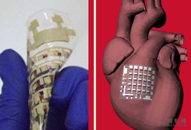 植入式装置可以监测和治疗心脏病 中国机械网,okmao.com