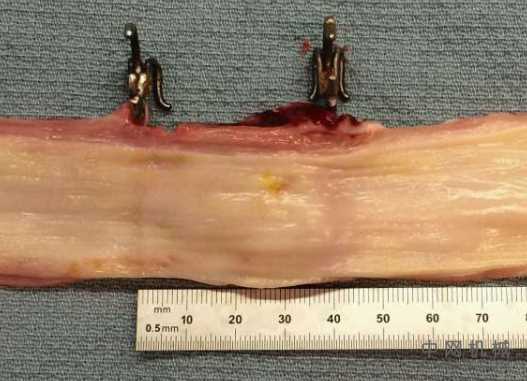 机器人植入物刺激体内的组织再生 中国机械网,okmao.com