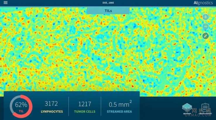 使AI在医学中的作用可以解释 中国机械网,okmao.com